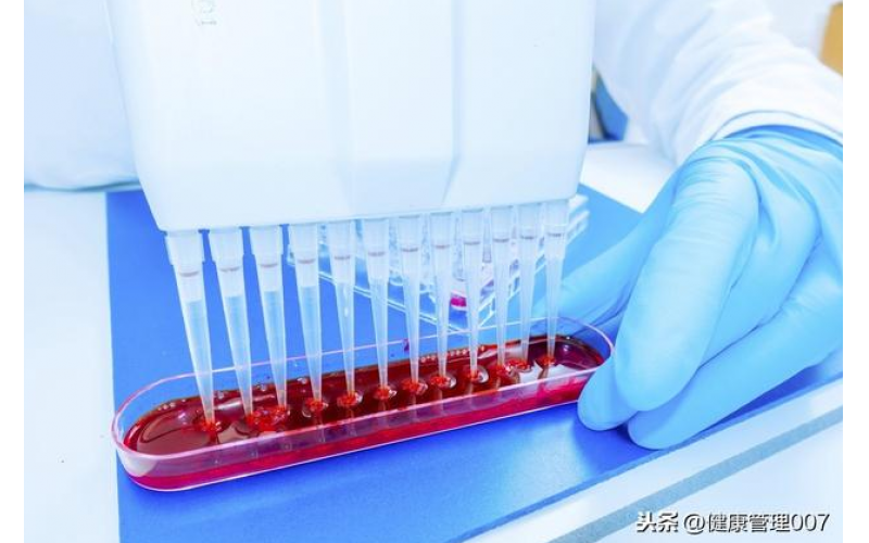上?？諝鈾z測項目清單及費用